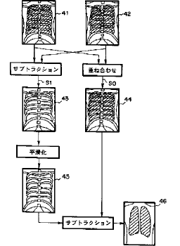 Representative Drawing